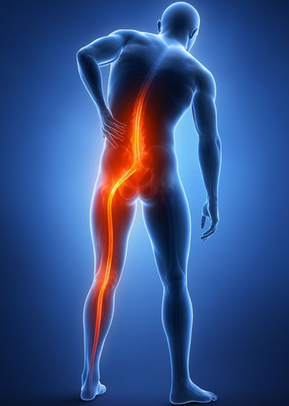 Low Back Pain
